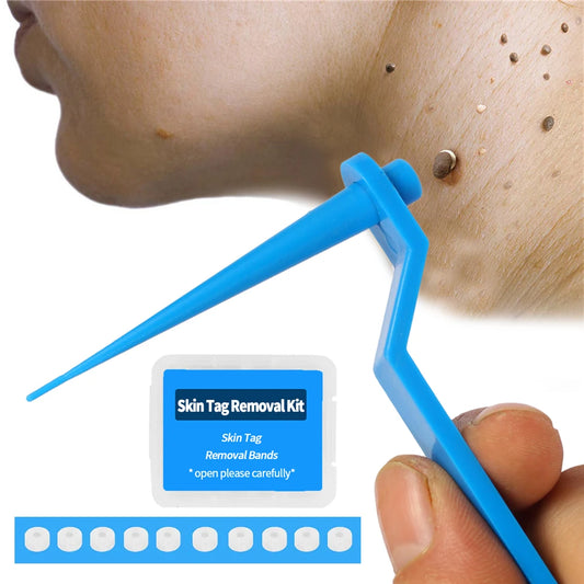 Medical Skin Tag Kill Mole Wart Remover Micro Band Kit With Cleansing Swabs Adult Face Care