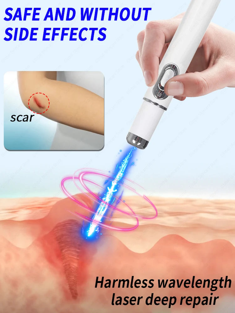 Cicatrice Laser.